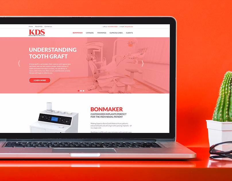 Sparkfn Project KDS Website